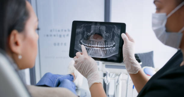 Licensed Wisdom Tooth Removal service in North Rock Springs, WY - Smile Center Dentistry